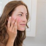 5 Cara Mengatasi Kulit Sensitif dengan Tepat