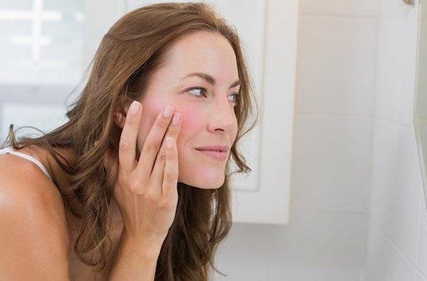 5 Cara Mengatasi Kulit Sensitif dengan Tepat