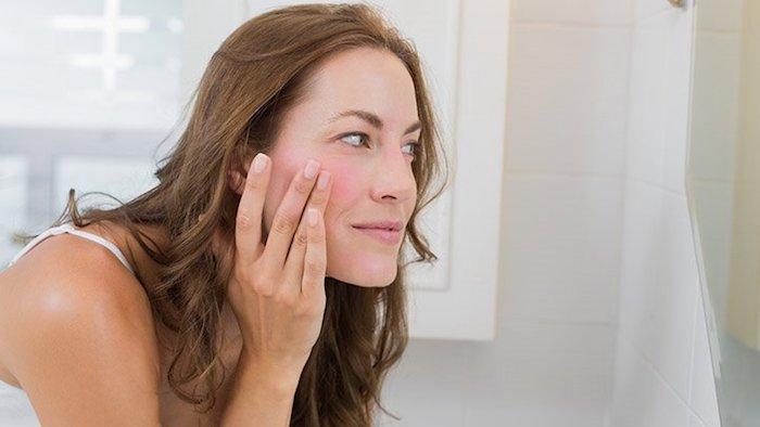 5 Cara Mengatasi Kulit Sensitif dengan Tepat