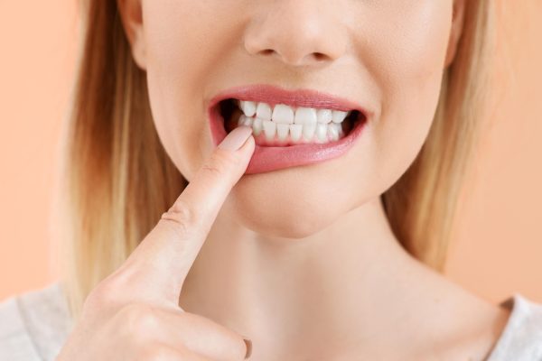 10 Cara Mencegah Gusi Turun di Usia Muda 10 Cara Mencegah Gusi Turun di Usia Muda