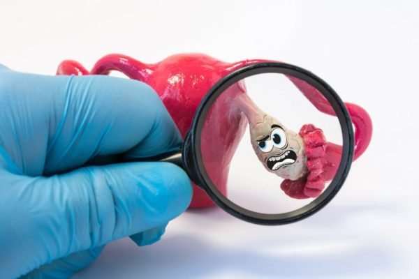 5 Cara Mengelola Sindrom Ovarium Polikistik (PCOS) dengan Tips Kesehatan Hormon 5 Cara Mengelola Sindrom Ovarium Polikistik (PCOS) dengan Tips Kesehatan Hormon
