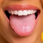7 Cara Sederhana Mendeteksi Masalah Kesehatan Lewat Lidah