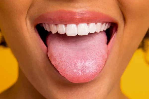 7 Cara Sederhana Mendeteksi Masalah Kesehatan Lewat Lidah