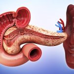 5 Tips Mengurangi Risiko Infeksi pada Limpa