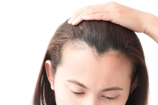 10 Strategi Mengatasi Rambut Tipis dan Menipis