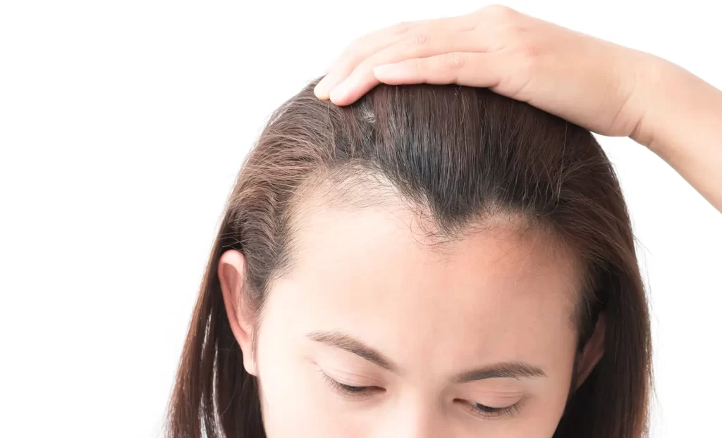 10 Strategi Mengatasi Rambut Tipis dan Menipis