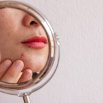 7 Tips Menghindari Jerawat Saat Menstruasi